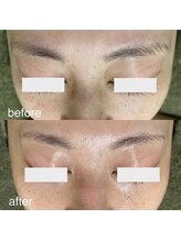 サロンドジェシカ(salon de Jessica)/毛穴洗浄＋フォト美顔
