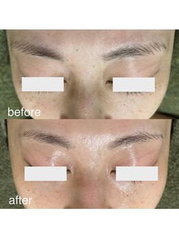 サロンドジェシカ(salon de Jessica)/毛穴洗浄＋フォト美顔