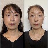 ハレトケ(HARE TO KE)