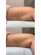 ブリア 横浜(BRILLA)/肩・首・背中、贅沢な上半身ケア