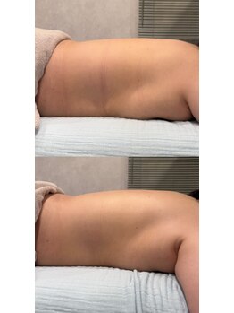 ブリア 横浜(BRILLA)/肩・首・背中、贅沢な上半身ケア