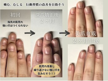 クウ(KUU)/深爪→美爪