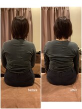 ヴィラ整骨院/肩の高さの改善（50代女性）