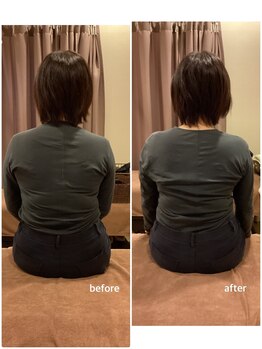 ヴィラ整骨院/肩の高さの改善（50代女性）