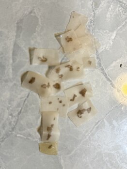 ヘルシーアンドビューティー でわ/シミ回収