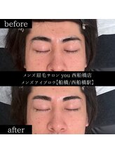 ユー 西船橋店(you)/ビフォーアフター写真