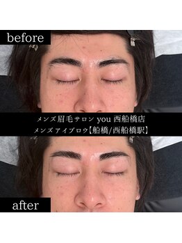 ユー 西船橋店(you)/ビフォーアフター写真