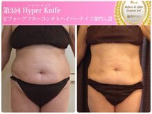 【第3回優秀サロン】を受賞されたお客様