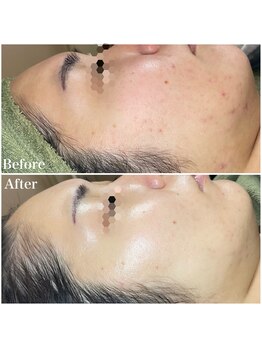 ちらちゅら/クリスティーナ