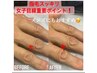 手・足の指毛脱毛