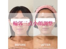メディカルサロン レムリアの雰囲気（1回でも即実感！大人気小顔調整！）