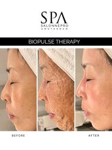 スキンラウンジ(SKIN LOUNGE)/欧州発！バイオパルスセラピー