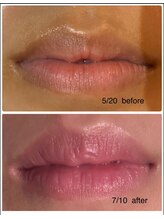 リュミエール デスポワール(Lumiere d'espoir)/ROMAPINK ローマピンク