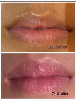 リュミエール デスポワール(Lumiere d'espoir)/ROMAPINK ローマピンク