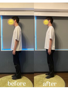 灯(akari)/猫背改善!お客様変化☆20代男性