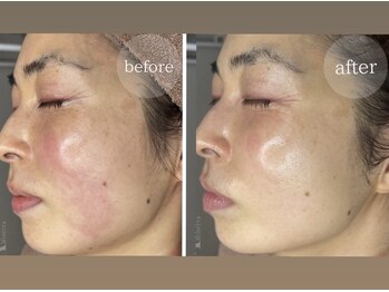 アンドエピ(&epi)/