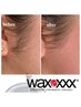 【7・8月限定】全顔ライスWAX＋VOSパック付（3300円相当）75分