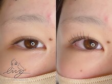 エニー 金剛(eny)/パリジェンヌ＋ダブルアイリフト