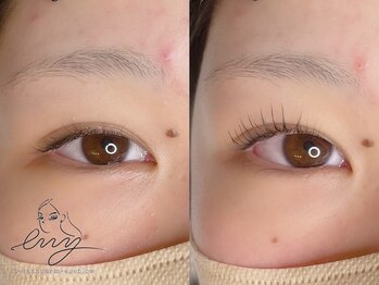 エニー 金剛(eny)/パリジェンヌ+ダブルアイリフト