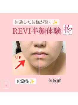 リリイ(Lily)/体験した皆さんが驚く半顔体験！