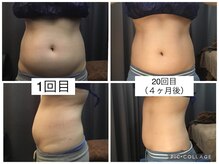 ベルスティン 中村橋本店(Belstin)/ぽっこりお腹解消