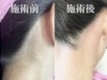 ラニブロウ(Lani brow)/うなじWAX♪