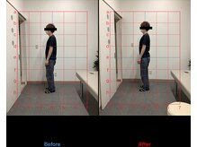 リード整骨院(LEAD整骨院)/繰り返す腰痛でお悩みの方