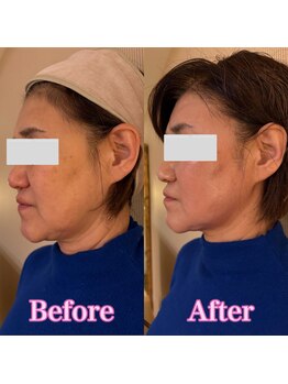 ヨウキ(YOKI)/フェイスラインもクッキリ!