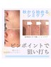 シミケアに◎【シミペンシル×プラズマフォト】本気のシミケアコース◎