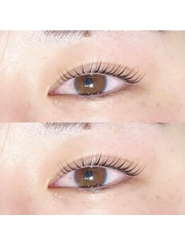 アンド アイ(And Eye)/ラッシュリフト