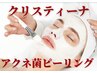 【ニキビケア/テカリ/脂性肌】クリスティーナ★アクネケアピーリング￥16500