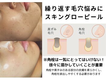 コキュウ お顔ラボ(KOKYU お顔LABO)/あなた毛穴の種類は？