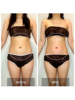 ウィズ ユー ビューティ(with U beauty)/くびれキュッ