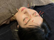たかはし治療院の雰囲気（美容鍼で小顔効果UP◎シワ・たるみ改善やほうれい線にもお勧め！）