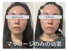 ルリアン(Lurian)/1回でのBefore→After