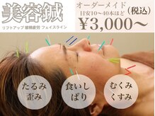 きえ鍼灸整骨院