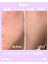 エイチ アンド イー(H&E)/