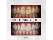 ホワイトニングショップ 徳島店の雰囲気（タバコによるヤニ汚れもしっかり落ちます！#ホワイトニング#徳島）