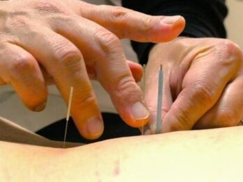 エクラ 鍼灸院(Eclat)の写真/不調がぶり返す原因を究明＆的確アプローチ★だから、良い状態が続く!どうせまた元に戻る…から卒業できる!