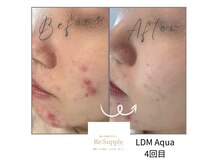 リサプリ(Re: Supple)