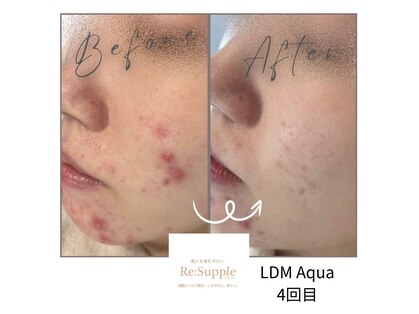 リサプリ(Re: Supple)の写真