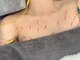 バスト鍼ラボ 代々木上原(BUST 鍼LAB.)の写真/肩こり・姿勢から変える≪美容鍼≫国家資格者の専門ケアで、ふっくらハリのある理想のバストラインへ。