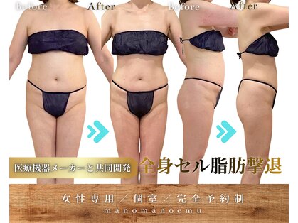 マノマノ エミュー(manomano emu)の写真