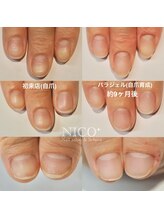 ニコプラス(NICO+)/自爪育成パラジェルクリア補強