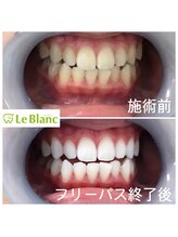 ルブラン 奈良店(Le Blanc)/自己投資しませんか？