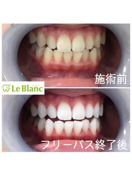 ルブラン 奈良店(Le Blanc)/自己投資しませんか?