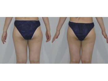 アルマ 芦屋(ALMA)/痩せにくいパーツランキング