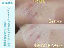 RiとBiのたまご
