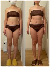 ラルーエ 仙台/ベーシック筋膜リリースの変化