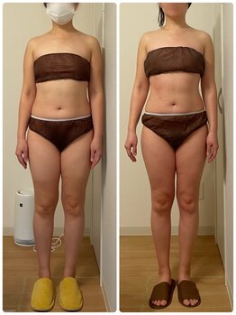 ラルーエ 仙台/ベーシック筋膜リリースの変化